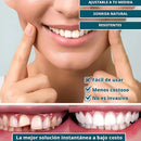 COMPRA 1 LLEVATE 4 SmilePro 🦷 - Carillas Dentales Ajustables De Resina + ESTUCHE REGALO - ¡Últimas unidades!