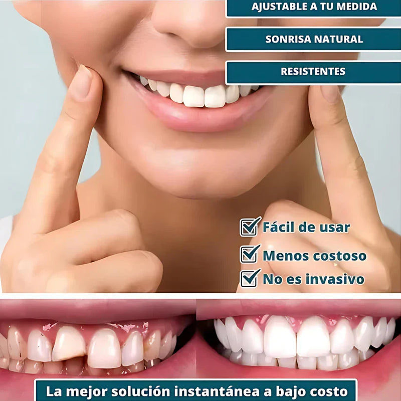 COMPRA 1 LLEVATE 4 SmilePro 🦷 - Carillas Dentales Ajustables De Resina + ESTUCHE REGALO - ¡Últimas unidades!