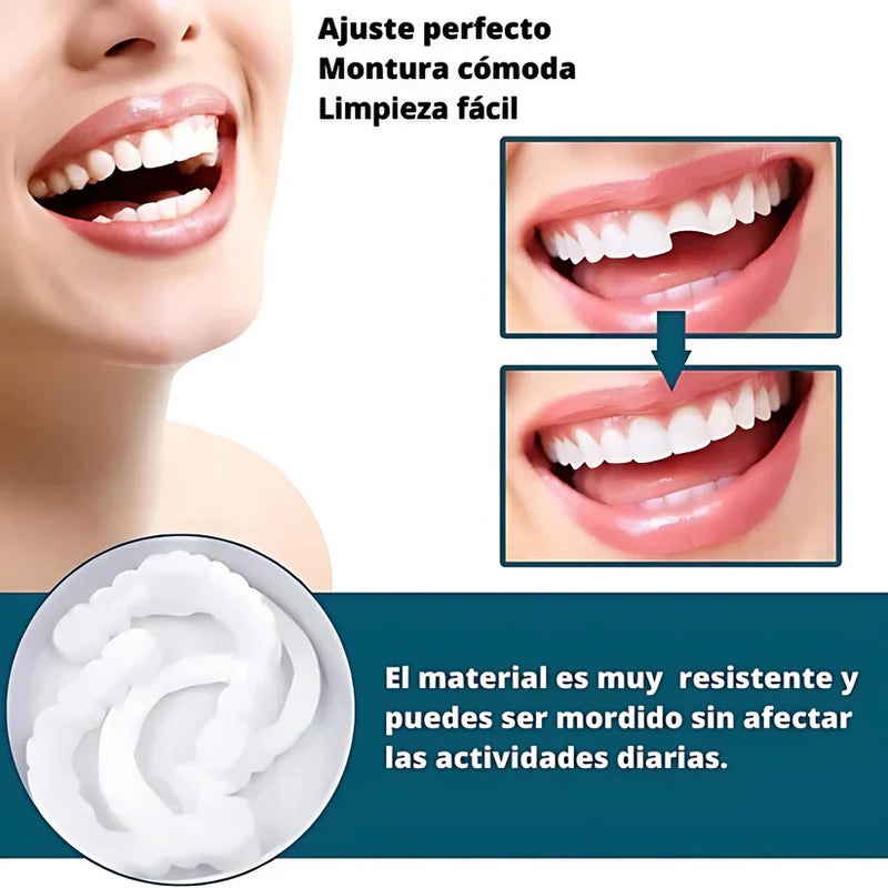 COMPRA 1 LLEVATE 4 SmilePro 🦷 - Carillas Dentales Ajustables De Resina + ESTUCHE REGALO - ¡Últimas unidades!